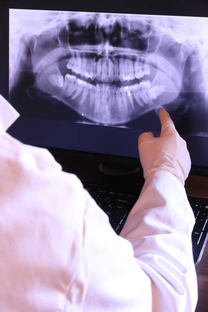 Best Emergency Root Canal Treatment in Lehi, UT