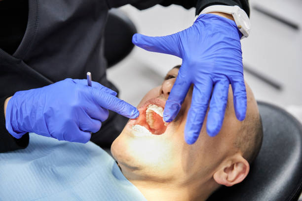 Best Emergency Wisdom Teeth Removal in Lehi, UT